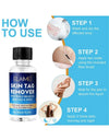 Skin Tag Remover