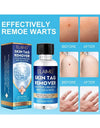 Skin Tag Remover
