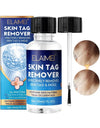 Skin Tag Remover