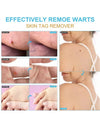 Skin Tag Remover