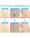 Skin Tag Remover